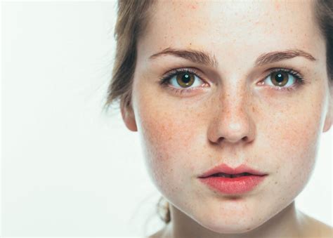 Freckles Skincare