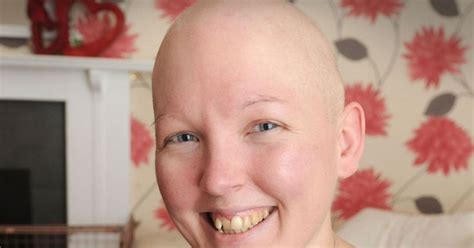 Brave Mums Battle To Beat Alopecia Alopecia Her Hair Hair Loss