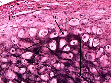 Fibrocartilage Connective Tissue Labeled