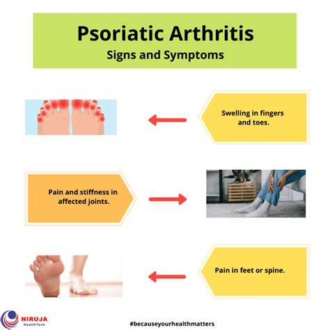 Psoriatic Arthritis Signs And Symptoms