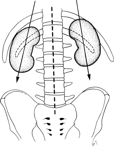 Surgical Anatomy Of The Kidney For Endourological Procedures