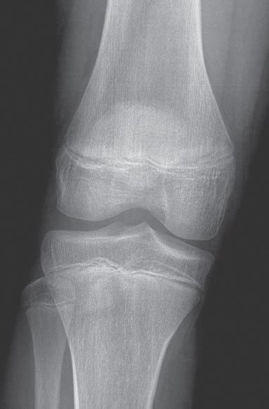 Male Knee Radiology Key