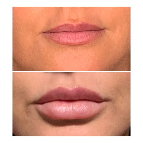 lips proportion is everything shape clinic online