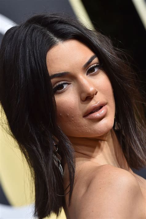 Kendall Jenner Finally Sets The Record Straight On Her Acne And It’s Empowering British