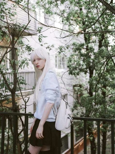 Nastya Kumarova Albino Girl Albino Model Female Character Inspiration