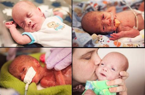 Precioso Vídeo En Time Lapse Del Crecimiento De Un Bebé Prematuro