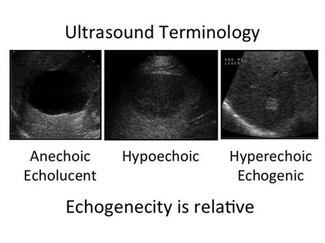 Ultrasound And Lumbosacral Anatomy Dr Lockwood 12418 Lec And Lab