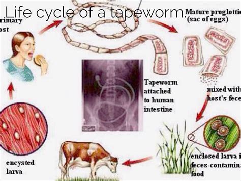 Pork Tapeworm Infection Pictures