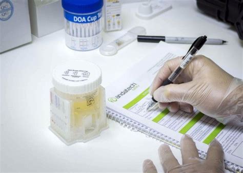 What Employees Need To Know About Dot Drug Testing