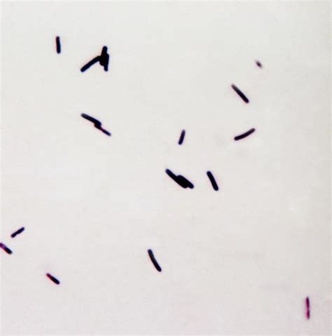 Clostridium Difficile Infection Laboratory Findings Wikidoc