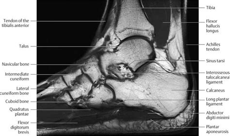 Ankle And Foot Radiology Key