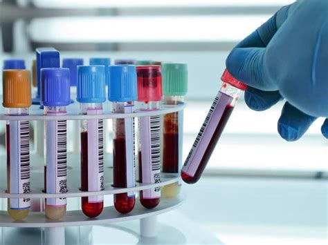 Some Important Diagnostic Tests Dr Mnc Pathology Lab
