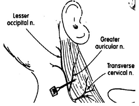 Greater Auricular Nerve Download Scientific Diagram
