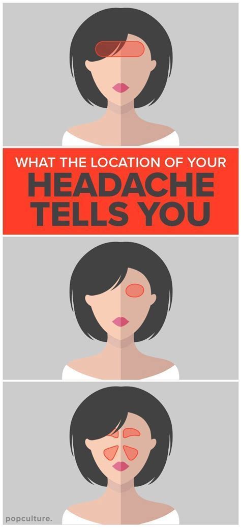 What The Location Of Your Headache Is Telling You Headache Location Tension Headache
