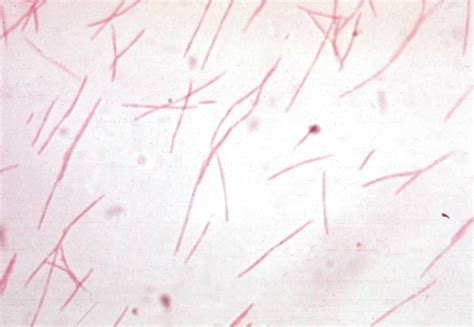 Fusobacterium Nucleatum Microbewiki