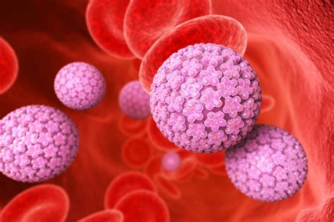 VPH en hombres claves para entenderlo y prevenirlo Urólogos en Vallarta