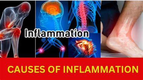 Causes Of Inflammation Youtube