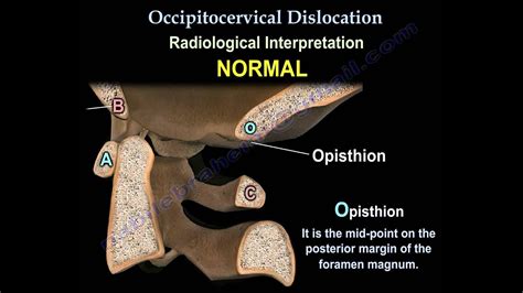 Everything You Need To Know About The Occipital Nerve