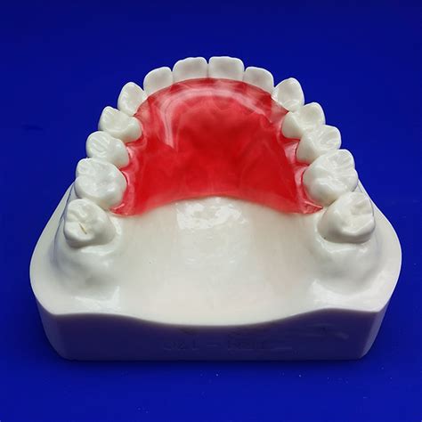 Clear upper retainer, custom made, affordable dental retainers, online retainers. Hawley Retainer | Discount Online Dental
