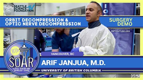 Orbit Decompression And Optic Nerve Decompression Arif Janjua Md