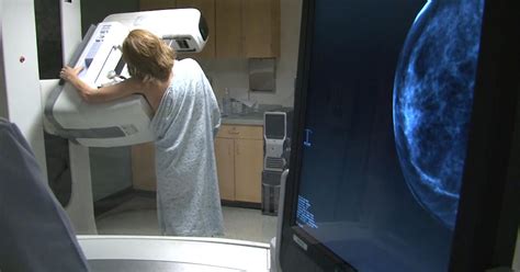 Diagnostic Mammograms Detect More Breast Cancers But Also Result In