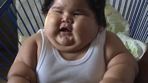 Cómo se explica la obesidad de Luis Manuel el bebé mexicano que a los meses pesa kilos