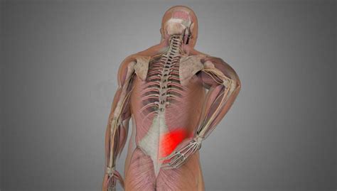 It is suspended from the trunk by muscles and a small skeletal articulation between the clavicle and the sternum—the sternoclavicular joint. Low back Sprain-Strain - ShimSpine