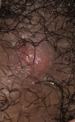 Fotos De Vagina Afeitada Nuevos Videos Porno