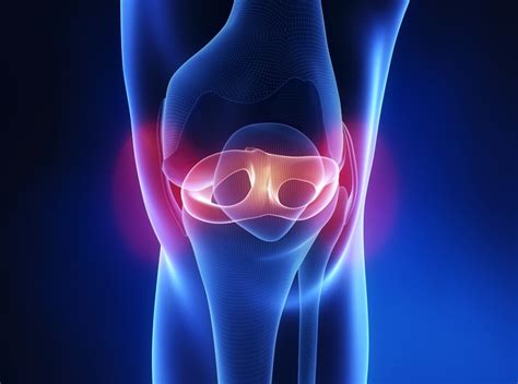 We did not find results for: Meniscus Repair Helps Prevent Arthritis | HuffPost