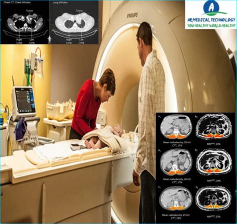 Mri Vs Ct Scan For Cancer Whats The Difference Best Way To Learn 23