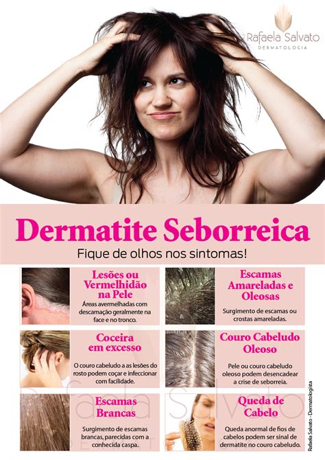 Dermatite Seborreica Rafeala Salvato Dermatologia Dermatologista