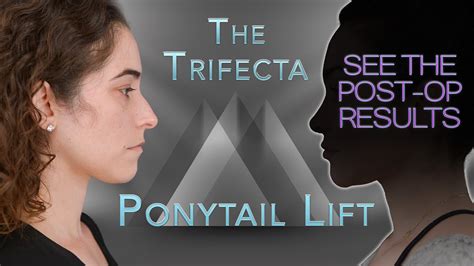 Ponytail Lift And The Trifecta Of Beauty Cosmetic Beautification By