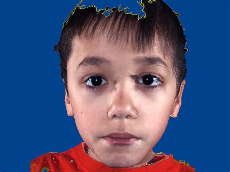 is it autism facial features that show disorder photo 3 pictures cbs news