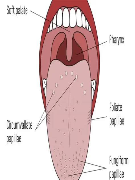 Transient Lingual Papillitis Lie Bumps Features Causes And Treatment Tips