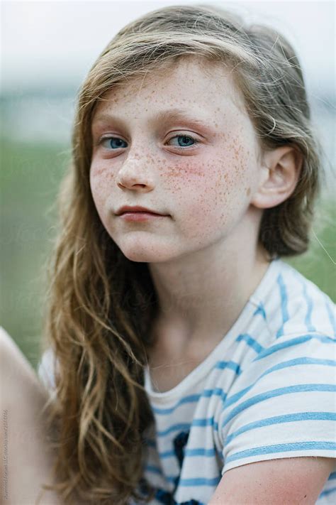 Portrait Of Pensive Young Redhead Girl With Freckles By Stocksy Contributor Raymond Forbes