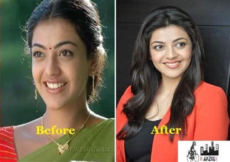 Tollywood Actress Plastic Surgery Before And After