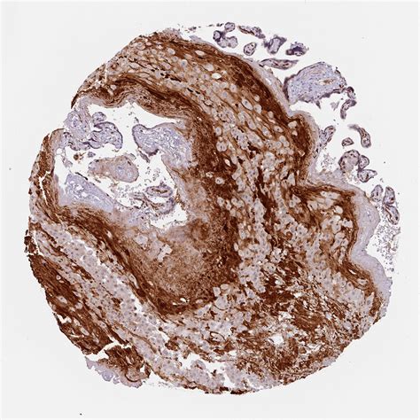 Tissue Expression Of Cd34 Staining In Placenta The Human Protein Atlas