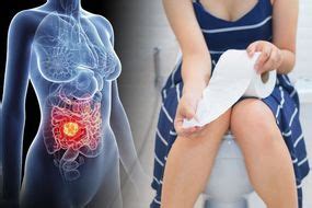 Symptoms of metastatic testicular cancer can include: Testicular cancer symptoms: Cough could be sign the ...