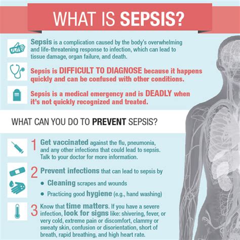 Sepsis is actually a clinical syndrome with a wide range of abnormalities such as biochemical and physiological conditions that occurs due to a dysregulated immune response of. Saving Patients from Sepsis | CDC Online Newsroom | CDC