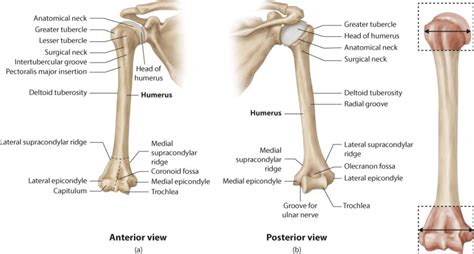Humeral Diaphyseal Fractures Musculoskeletal Key