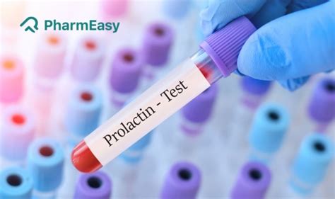 प्रोलैक्टिन टेस्ट prolactin test क्या है खर्च नॉर्मल रेंज कैसे होता है क्यों और कब