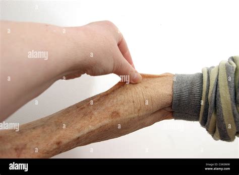 Checking Skin Turgor Hi Res Stock Photography And Images Alamy