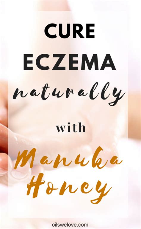 How To Use Manuka Honey For Eczema And Cure It Naturally Natural