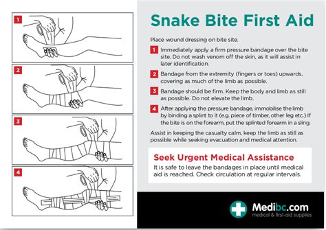 Be Prepared For Snake Season And Download Our Free Guide To Snake Bite