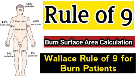 The rule of nines what is the significance of the amount of body area burned? Rule of 9 in Burn Patient को हिन्दी मे समझे | Rule of Nine ...