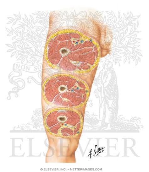 Serial cross sections variant image id: Cross-Sectional Anatomy of Thigh Thigh: Serial Cross Sections