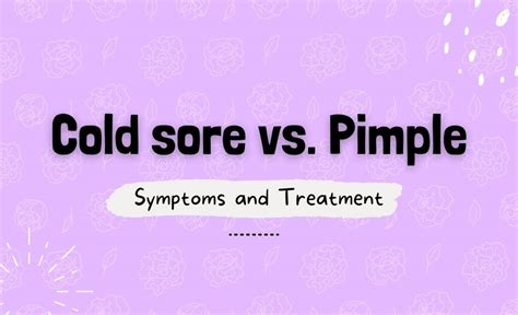 Cold Sore Vs Pimple Symptoms And Treatment Resurchify