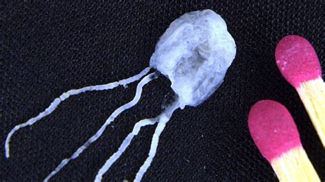 Today In Cairns Man Airlifted To Hospital After Jellyfish Sting The