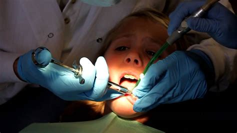 Cavity Dentist Shot Miaeroplano