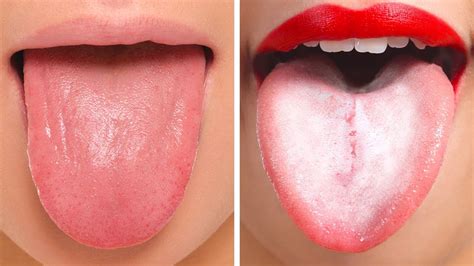 18 Things Your Tongue Is Trying To Tell About Your Health Youtube
